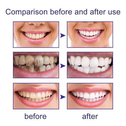"Free Shipping" Hismile V34 Purple Toothpaste – Remove Yellow Stains & Brighten Your Smile